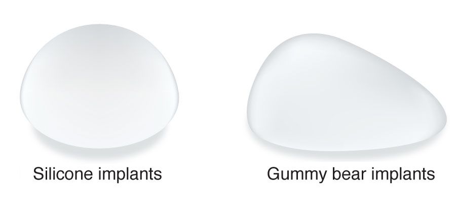 Side-by-side comparison of silicone implant and gummy bear implant.